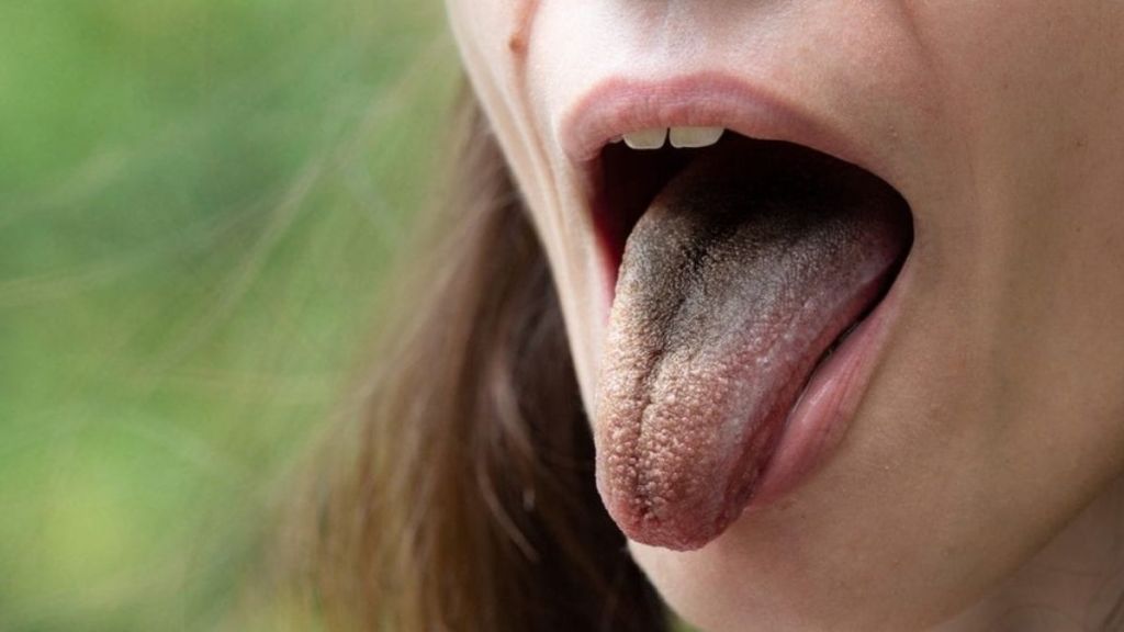 Brown Tongue 