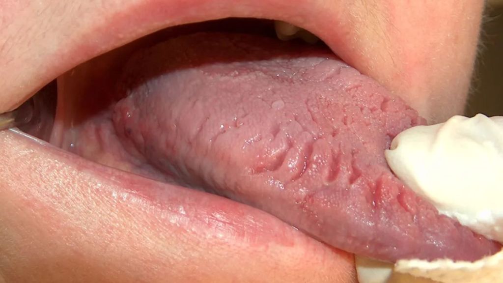 Tongue Health Tips