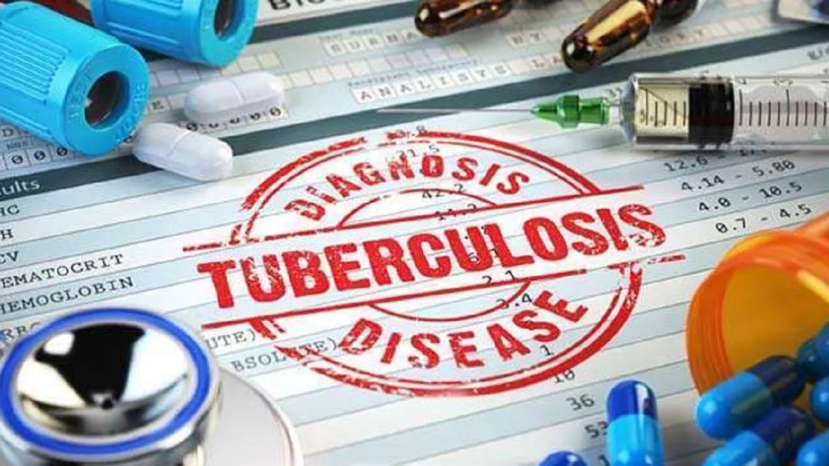 Tuberculosis Treatment 