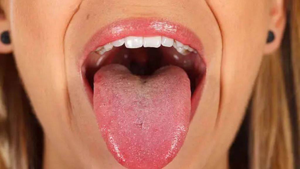 Tongue Bumps 